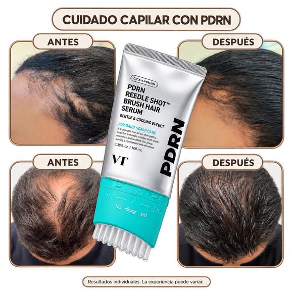 Feature product image